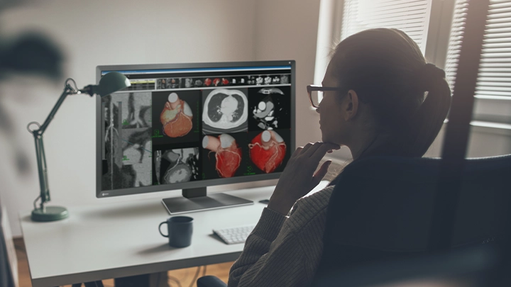 Choosing the Ideal Monitor for Teleradiology