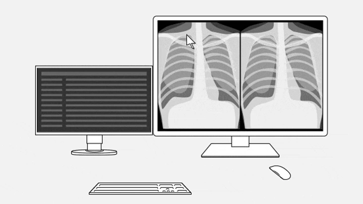 Supporting Radiologists' Needs - Comfortable Image Reading