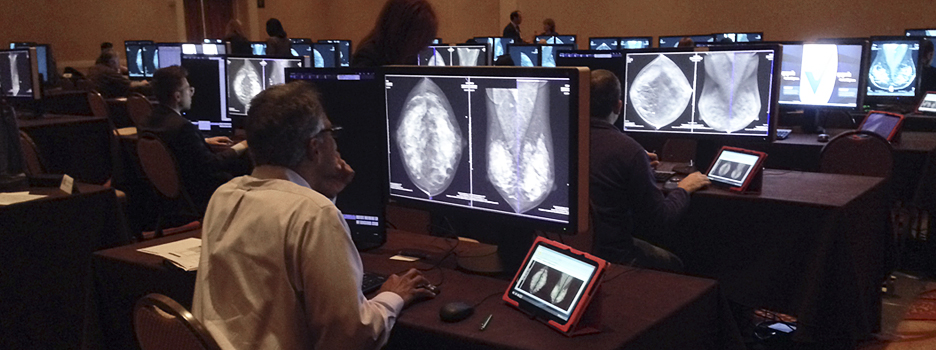 Society for Breast Imaging Advance Breast Imaging: Digital Tomosynthesis