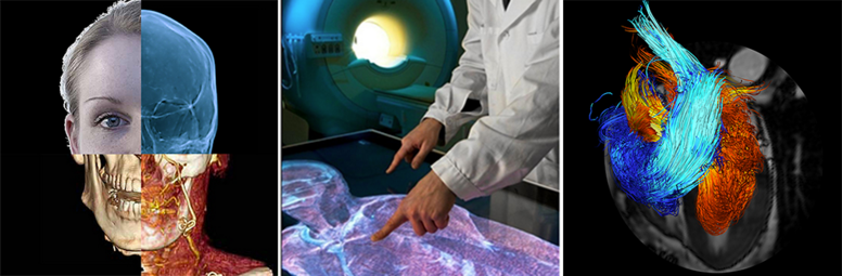 Center for Medical Image Science and Visualization CMIV