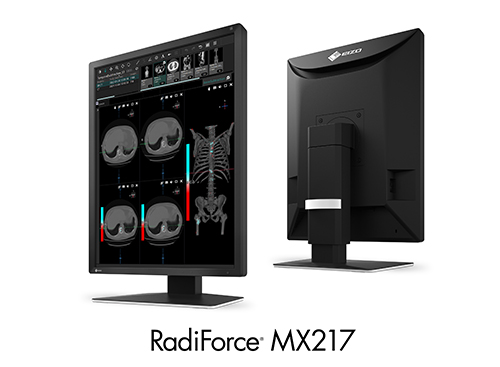 RadiForce MX217