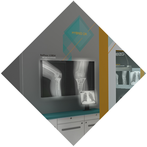 EIZO Interventional Radiology Solutions