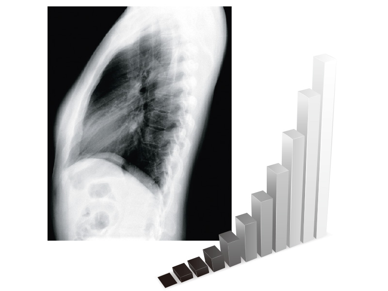 Mode préréglé DICOM