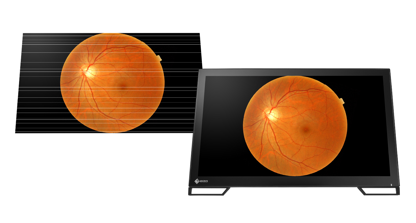 Visualisation sans scintillement