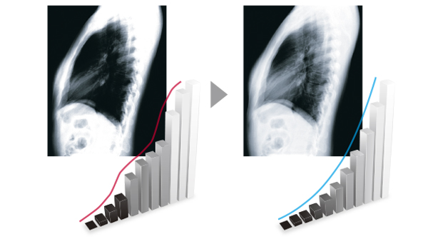 mx194_dicom.jpg