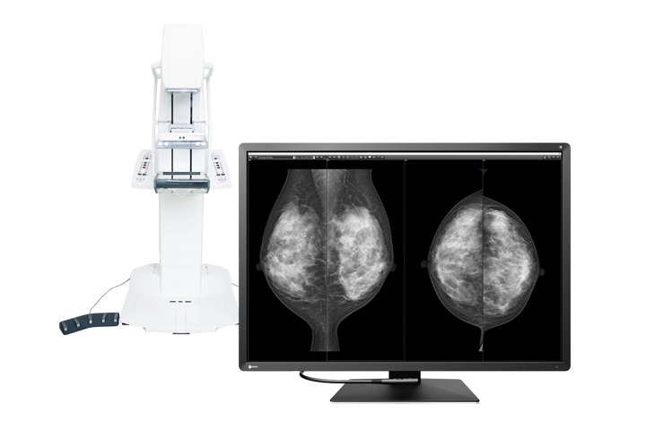 Optimum Breast Screening Monitor