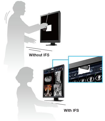 Manage Effortless Quality Control