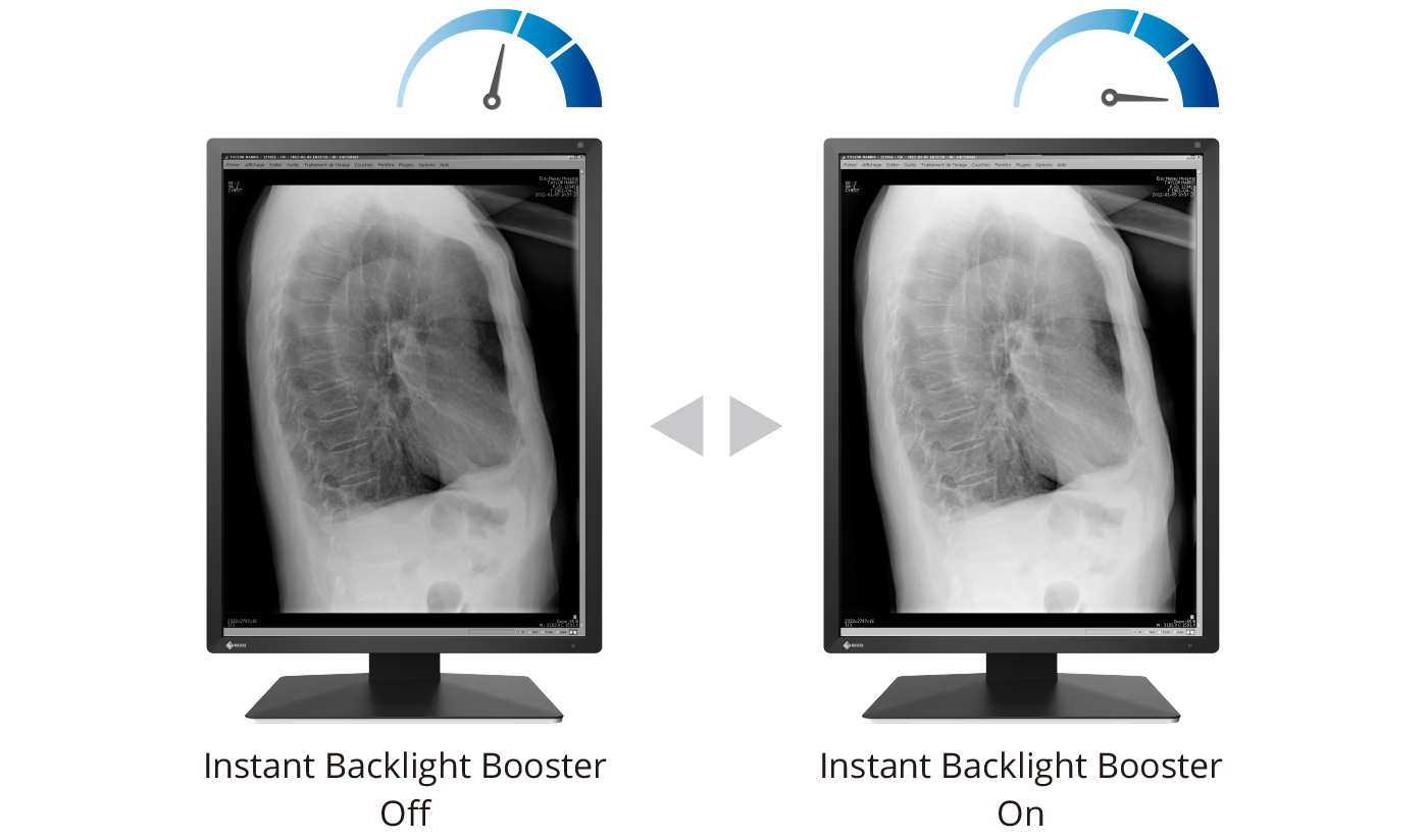 Instant Backlight Booster