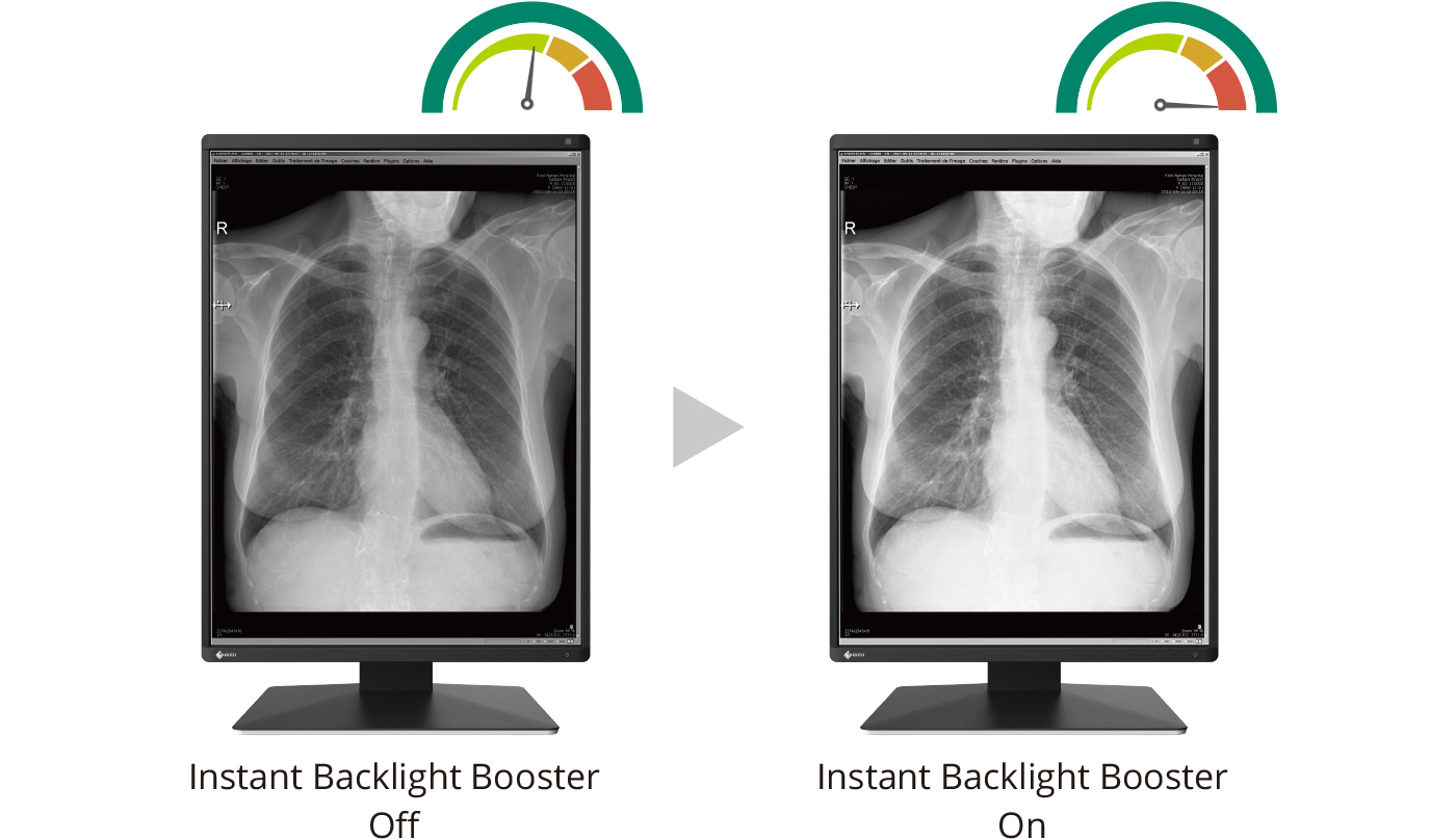 Instant Backlight Booster