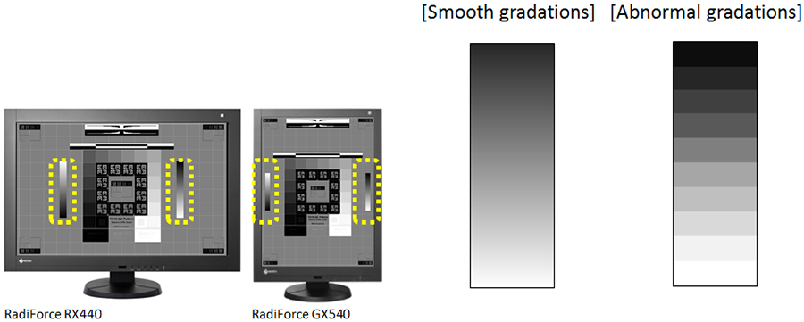 Check the RadiCS Pattern Indication